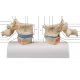 Model dvoch ľudských hrudných stavcov s osteoporózou