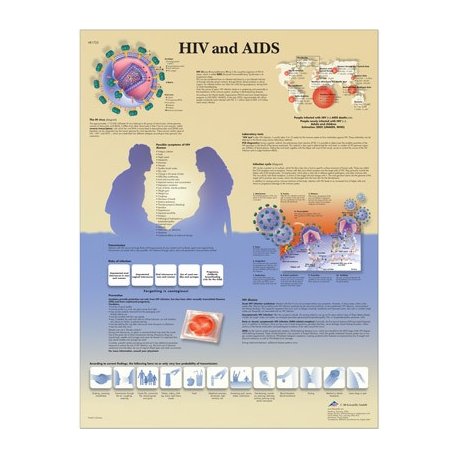Schéma - HIV vírus a AIDS - AJ - 50x67 cm