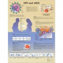 Schéma - HIV vírus a AIDS - AJ - 50x67 cm