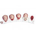 Simulátor pôrodu dieťaťa v piatich štádiách
