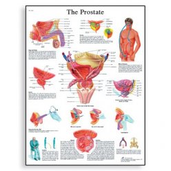 Schéma - ľudská prostata - AJ - 50x67 cm