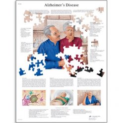 Schéma - Alzheimerova choroba - AJ - 50x67 cm
