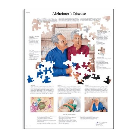 Schéma - Alzheimerova choroba - AJ - 50x67 cm