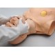 Model pre resuscitáciu