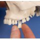 Model ľudskej lebky - dentálna - detail vybratého zuba