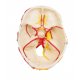 Neurovaskulárny model lebky - detail lebečnej klenby s tepnami