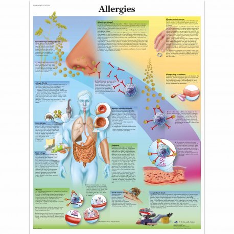 Schéma - alergia - AJ - 50x67 cm