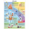 Schéma - alergia - AJ - 50x67 cm - DOPREDAJ
