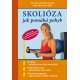 Skolióza – ako pomáha pohyb