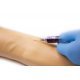 Model ľudskej paže pre tréning aplikácie intravenóznej injekcie a infúzie
